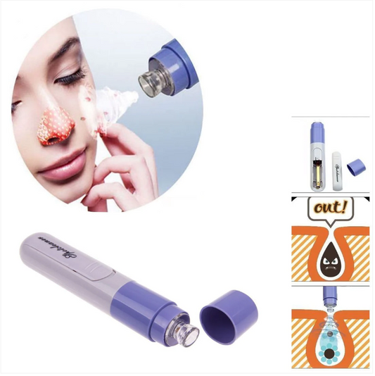 Electric Facial Pore Cleanser Face Blackhead Remover Skin Cleaner Tool